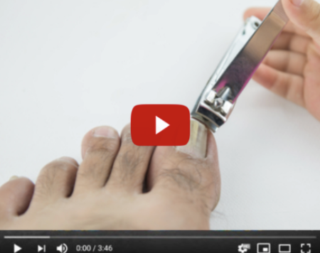 Nail Fungus - The Toxic Danger Hidden Inside Your Shoes